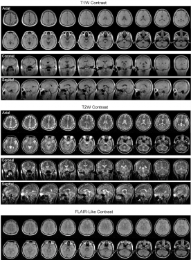 MRI images of a normal human subject produced at 0.055 Telsa
 